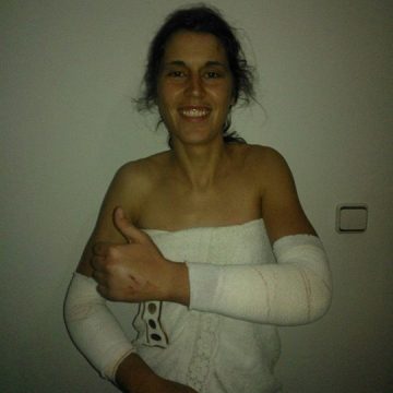 Vanessa Fernandes sofre queda aparatosa