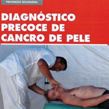 Diagnóstico precoce de Cancro de Pele em Almeirim