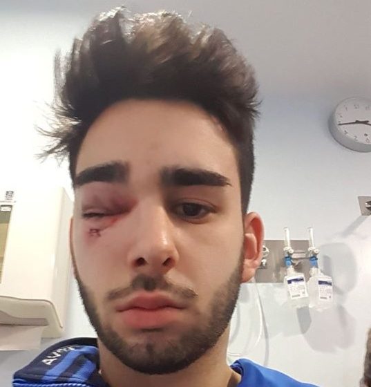 Frederico Neves lesionado com gravidade Frederico Neves lesionado com gravidade